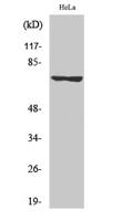 LIMK-1/2 (phospho Thr508/505) Polyclonal Antibody