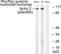 Lfc (phospho Ser886) Polyclonal Antibody