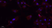 Lck (phospho Tyr393) Polyclonal Antibody