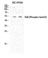 SGK1 (phospho Ser422) Polyclonal Antibody
