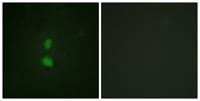 SNAI 1 (phospho Ser246) Polyclonal Antibody