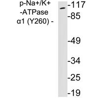 Sodium Potassium ATPase alpha-1 (Phospho Tyr260) Antibody