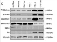 Histone H3 (Mono Methyl Lys27) Polyclonal Antibody