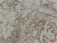 Pan Methylated Lysine Monoclonal Antibody(Mix)