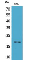 Acetyl eIF5A/eIF5A2 (K47) Polyclonal Antibody