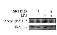 p53 (Acetyl K319) Polyclonal Antibody