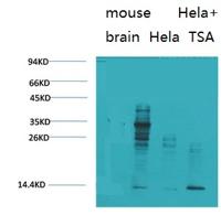 Acetyl Lysine Monoclonal Antibody(10B10)