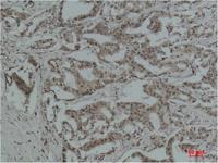 Acetyl Lysine Monoclonal Antibody(10B10)