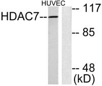 Histone deacetylase 7a Polyclonal Antibody