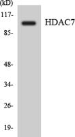 Histone deacetylase 7a Polyclonal Antibody