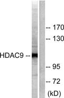 Histone deacetylase 9 Polyclonal Antibody