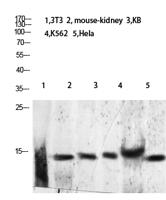 Histone H2B (Acetyl Lys24/25) Polyclonal Antibody