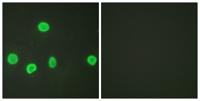 Histone H3 (Acetyl Lys18) Polyclonal Antibody