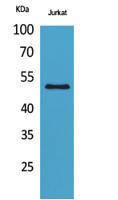 HNF-3α/β/γ (Acetyl Lys264/253/211) Polyclonal Antibody