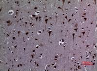 HSP 90 (Acetyl Lys292/284) Polyclonal Antibody