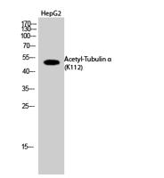 Tubulin α (Acetyl Lys112) Polyclonal Antibody