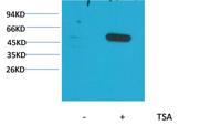 α-tubulin (Acetyl Lys40) Monoclonal Antibody(5H5)