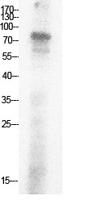 Ub (Acetyl Lys29) Polyclonal Antibody