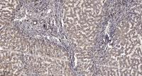 Rb (Acetyl-K873/K874) Polyclonal Antibody