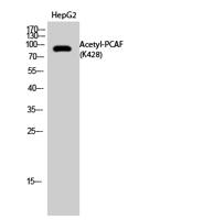 PCAF (Acetyl Lys428) Polyclonal Antibody