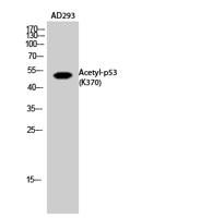 p53 (Acetyl Lys370) Polyclonal Antibody