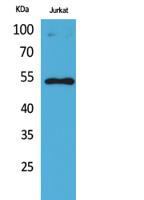 p53 (Acetyl Lys372) Polyclonal Antibody