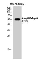 NFκB-p65 (Acetyl Lys218) Polyclonal Antibody