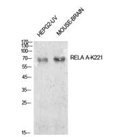 NFκB-p65 (Acetyl Lys221) Polyclonal Antibody