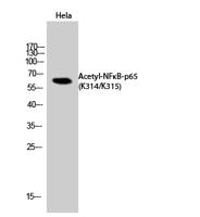 NFκB-p65 (Acetyl Lys314/Lys315) Polyclonal Antibody