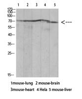 Ku-70 (Acetyl Lys317) Polyclonal Antibody