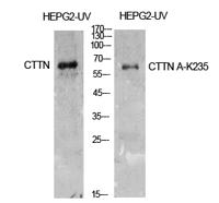 Cortactin (Acetyl Lys235) Polyclonal Antibody