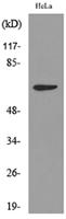 Cytokeratin-pan (Acetyl Lys194) Polyclonal Antibody