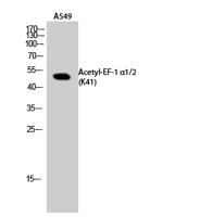 EF-1 α1/2 (Acetyl Lys41) Polyclonal Antibody