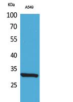 ATF-5 (Acetyl Lys29) Polyclonal Antibody