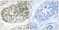 Ubiquilin-3 Polyclonal Antibody