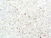 JAK1 mouse Monoclonal Antibody(7G6)