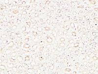 Collagen IV mouse Monoclonal Antibody(8E5)