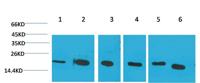 Cyclophilin B Monoclonal Antibody(1B3)