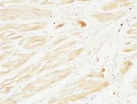 Cystatin C mouse Monoclonal Antibody(7F11)