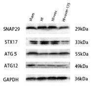 ATG5 (PTR1362) mouse mAb