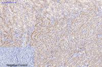 Catenin-β Monoclonal Antibody(4F2)