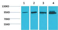 Catenin-β Monoclonal Antibody(4F2)