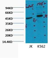 CD16 Monoclonal Antibody(Q32)