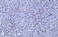 CD163 (ABT-CD163) mouse mAb