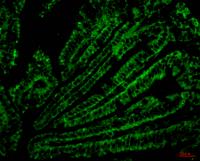 CD4 Monoclonal Antibody(11A1)