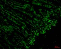 CD4 Monoclonal Antibody(11A1)