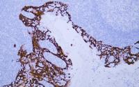 Cytokeratin 14 (PT1674) mouse mAb