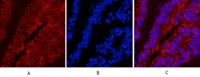 CK16 Monoclonal Antibody(6F6)