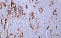 Cytokeratin 4 (ABT-CK4) mouse mAb