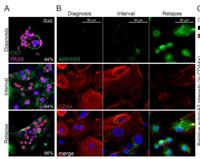 CK7 Monoclonal Antibody(12D7)